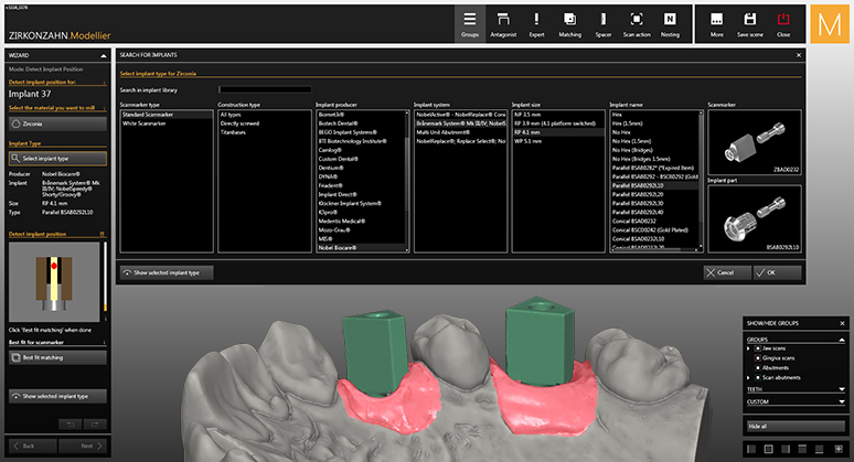 tooth shape template